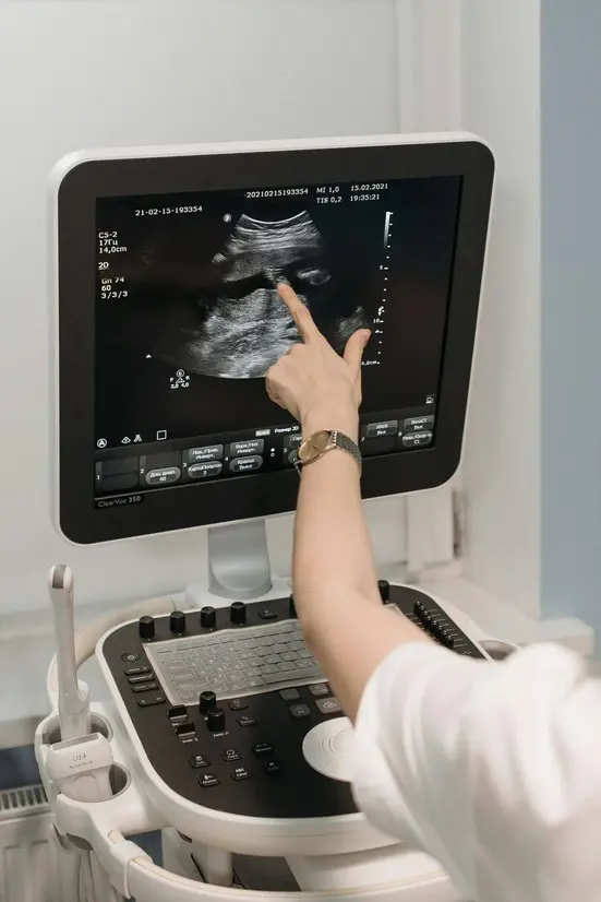 Ultrasound